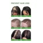 Disaar Rosemary Mint Scalp & Hair Growth Oil - Dry Scalp Treatment - Image 4