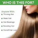 Disaar Rosemary Mint Scalp & Hair Growth Oil - Dry Scalp Treatment - Image 3