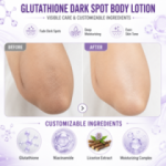 Strong Bleaching Glutathione Body Lotion: Dark Spot Remover & Whitening Cream for Knees, Elbows, Underarms & Private Parts - Image 2